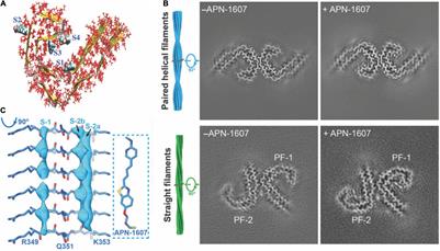 Amyloid and Tau Positron Emission Tomography Imaging in Alzheimer’s Disease and Other Tauopathies